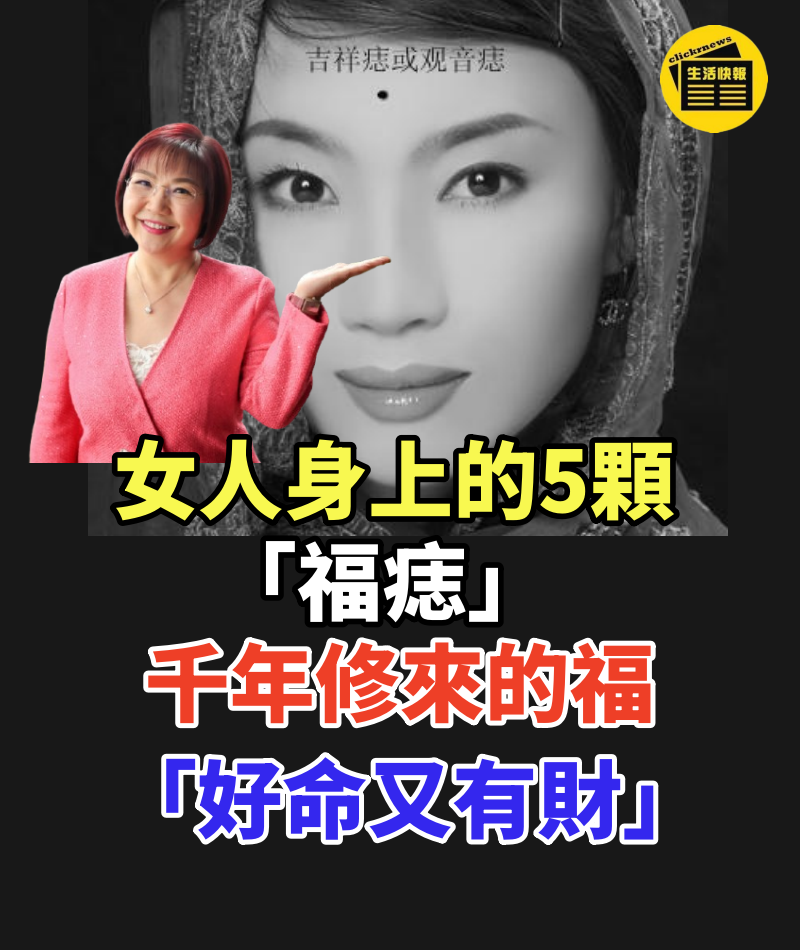 很難得！女人身上的5顆「福痣」千年修來的福 「好命又有財」千萬不要點掉