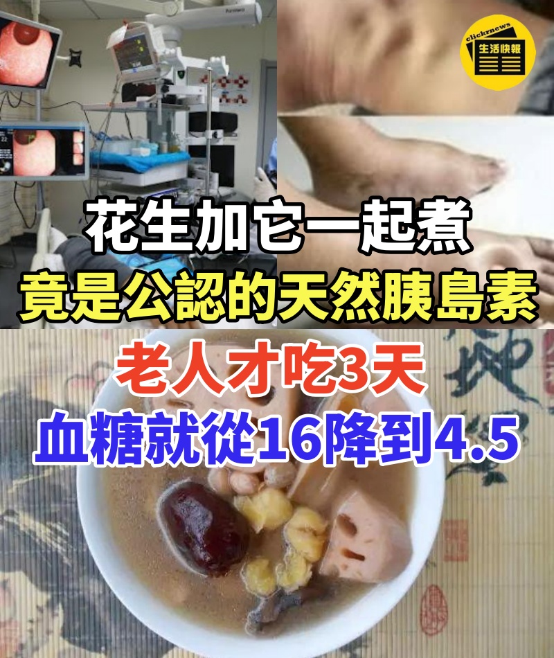 花生加它一起煮,竟是日本公認的天然胰島素!老人才吃3天,血糖就從16降到4.5,從此一輩子遠離糖尿病