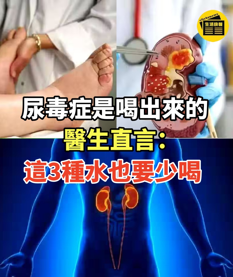 尿毒症是喝出來的?醫生直言:即使是鐵打的腎,這3種水也要少喝.