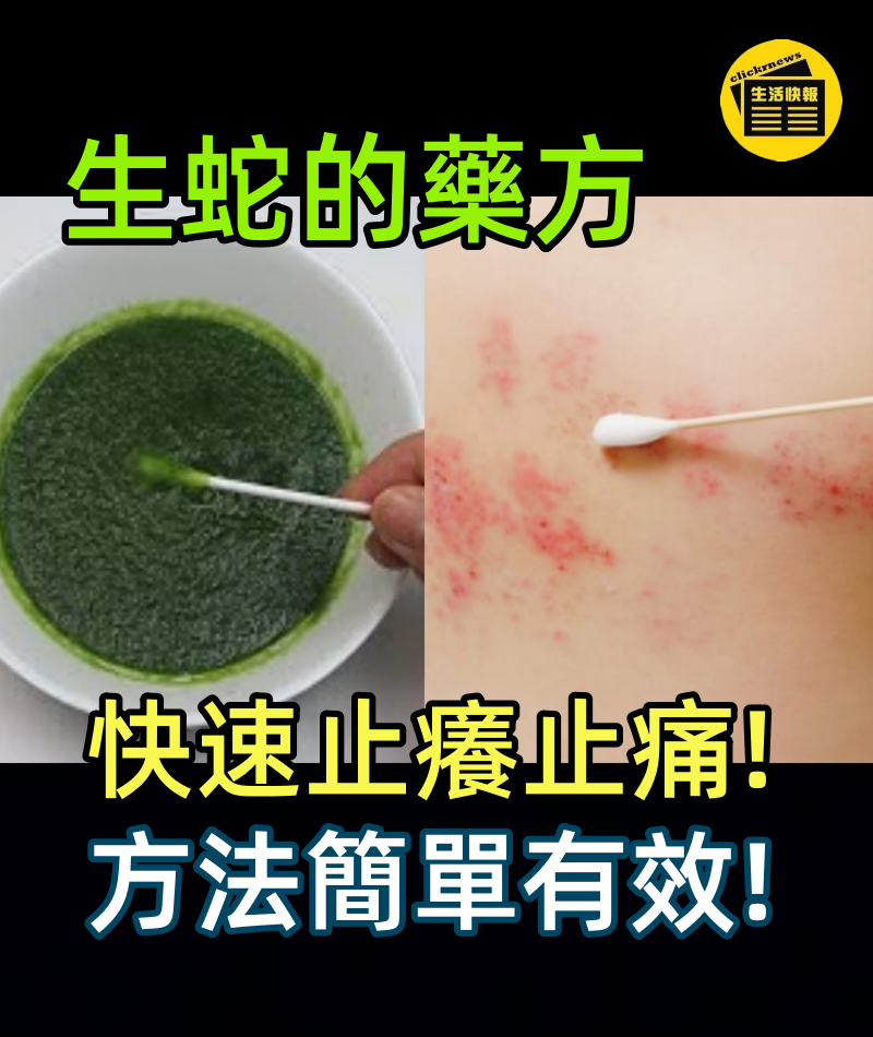 生蛇的藥方,快速止癢止痛,方法簡單有效!