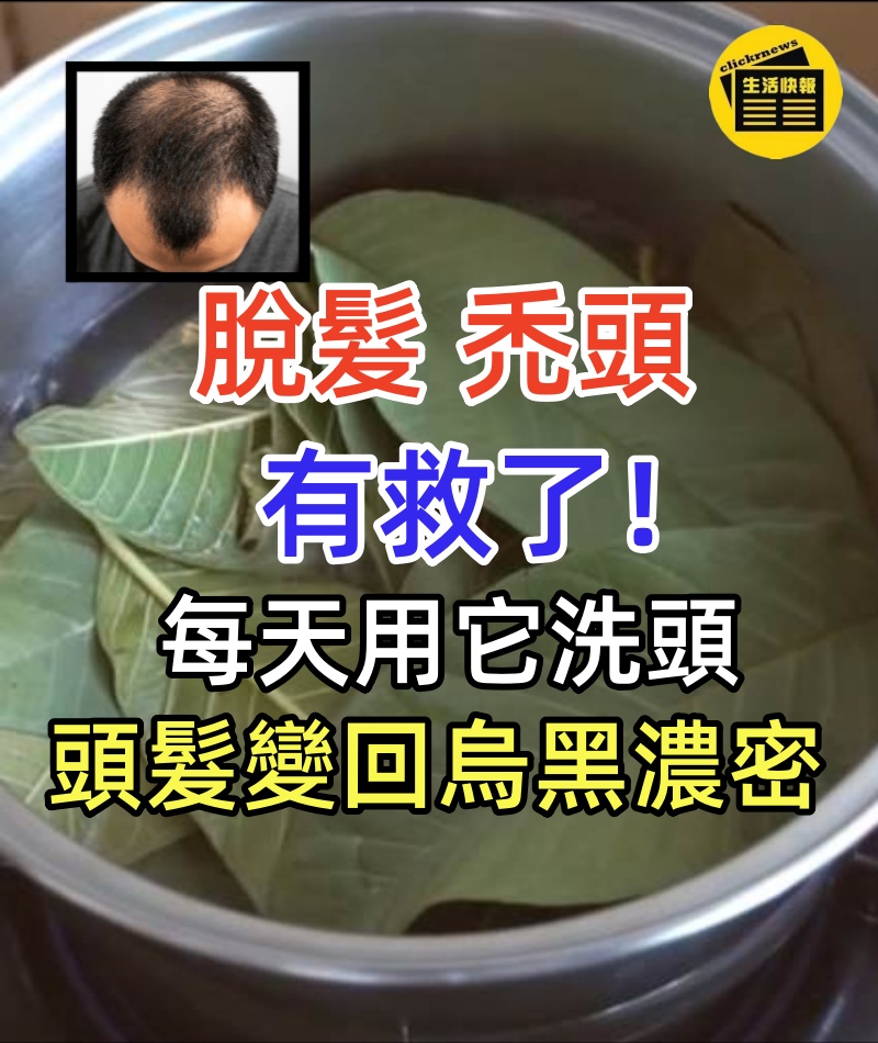 脫髮、禿頭有救了！每天用它洗頭，頭髮變回烏黑濃密，新頭髮也長出來了