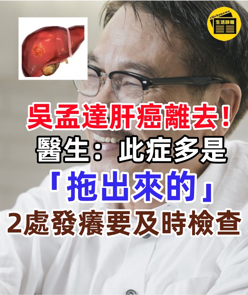 吳孟達肝癌離去!醫生提醒:此症多是「拖出來的」若身體2處「發癢」要及時檢查肝!
