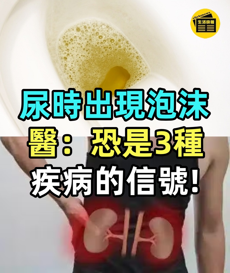 尿尿時為什麼會出現泡沫?是腎不好?醫生提醒:恐是3種疾病的信號!