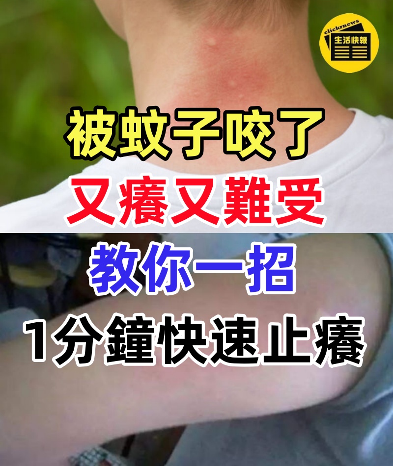被蚊子咬了又癢又難受！教你簡單一招，不用藥，1分鐘快速止癢