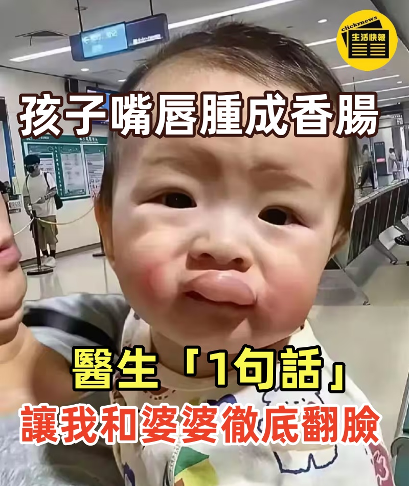 孩子交給婆婆帶半天,回家一看嘴唇腫成「香腸」!醫生「1句話」讓我和婆婆徹底翻臉