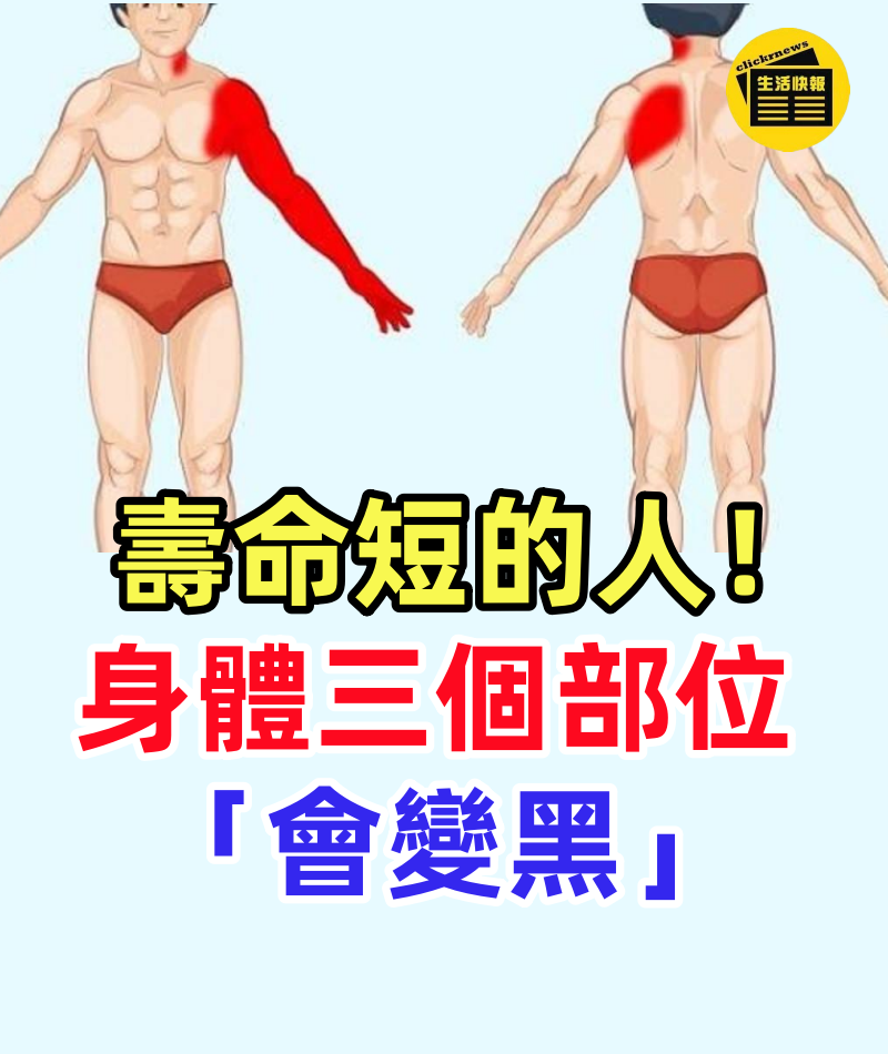 壽命短的人!身體三個部位「會變黑」 若3個都沒有:恭喜你很健康會長壽