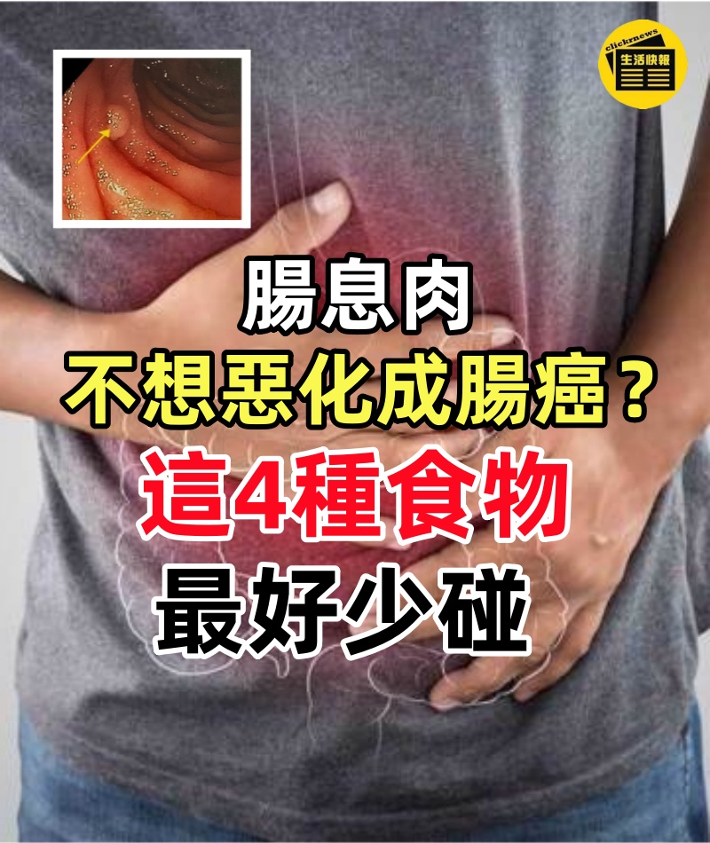 腸息肉不想惡化成腸癌？這4種食物最好少碰，再愛吃也要忍