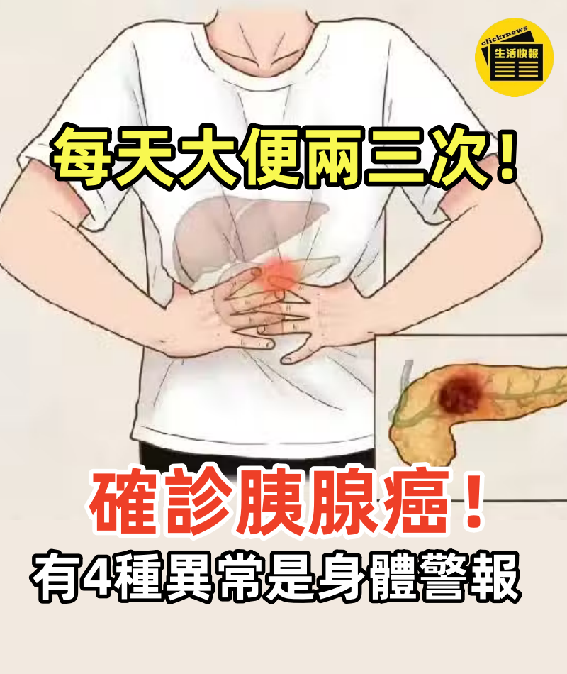 女子每天「大便兩三次」確診胰腺癌!醫生提醒:出現4種異常恐是身體「警報」