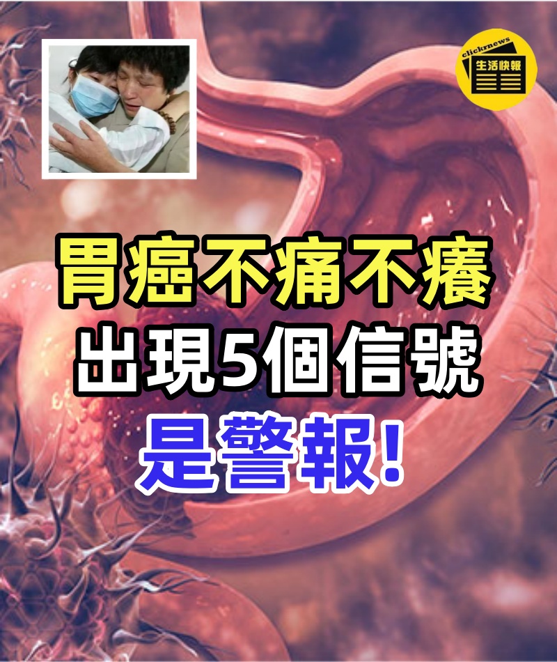 胃癌不痛不癢,一發現就是晚期,身體出現「5個信號」是警報,別再忽視了