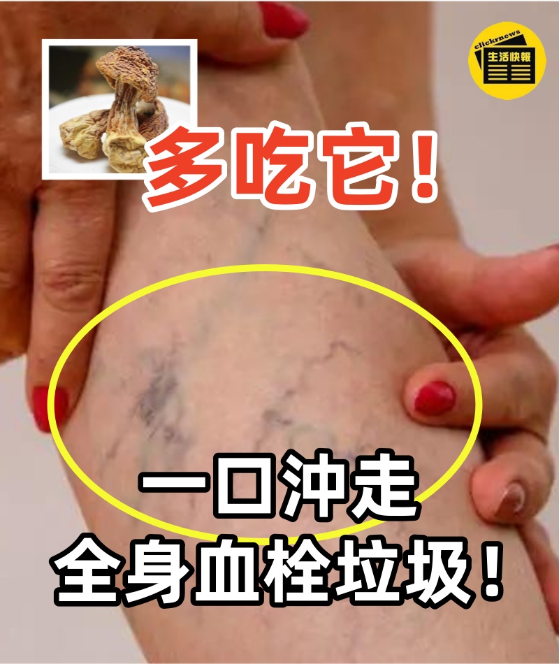 93歲老人竟有18歲血管,少吃香蕉蘋果多吃它,一口沖走全身血栓垃圾,到99歲都不得心血管病