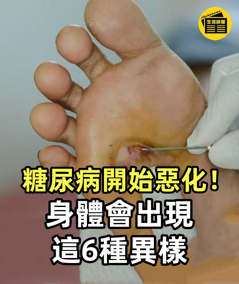 糖尿病開始惡化,身體會出現這6種異樣,一旦發現了,立馬去排查