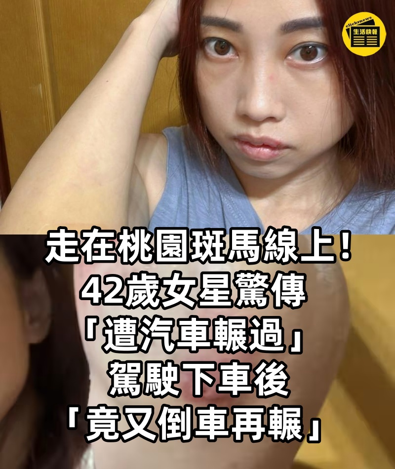走在桃園斑馬線上！42歲女星驚傳「遭汽車輾過」， 駕駛下車後「竟又倒車再輾」